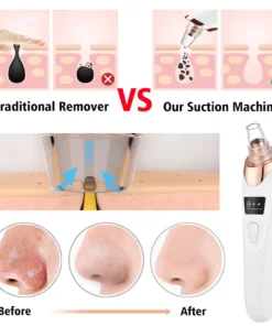 removedor de espinillas con 3 modos de succión, máquina de belleza para limpieza facial, eliminador de piel muerta, vacío facial, herramienta para el cuidado de la piel