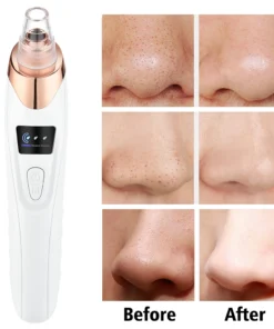 removedor de espinillas con 3 modos de succión, máquina de belleza para limpieza facial, eliminador de piel muerta, vacío facial, herramienta para el cuidado de la piel